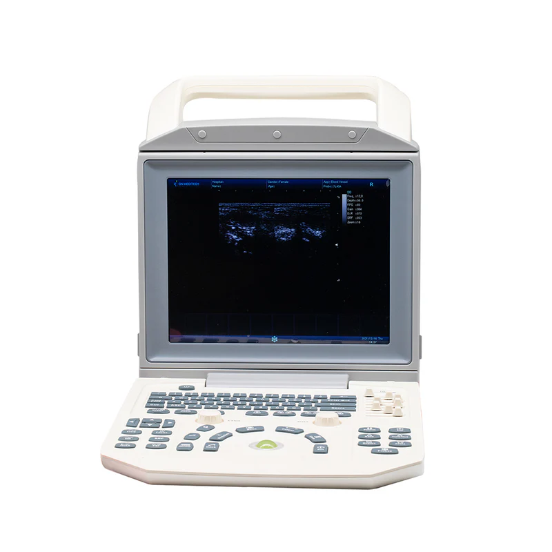 Black And White Ultrasound Machine Human Veterinary Outstanding Rotable Screen