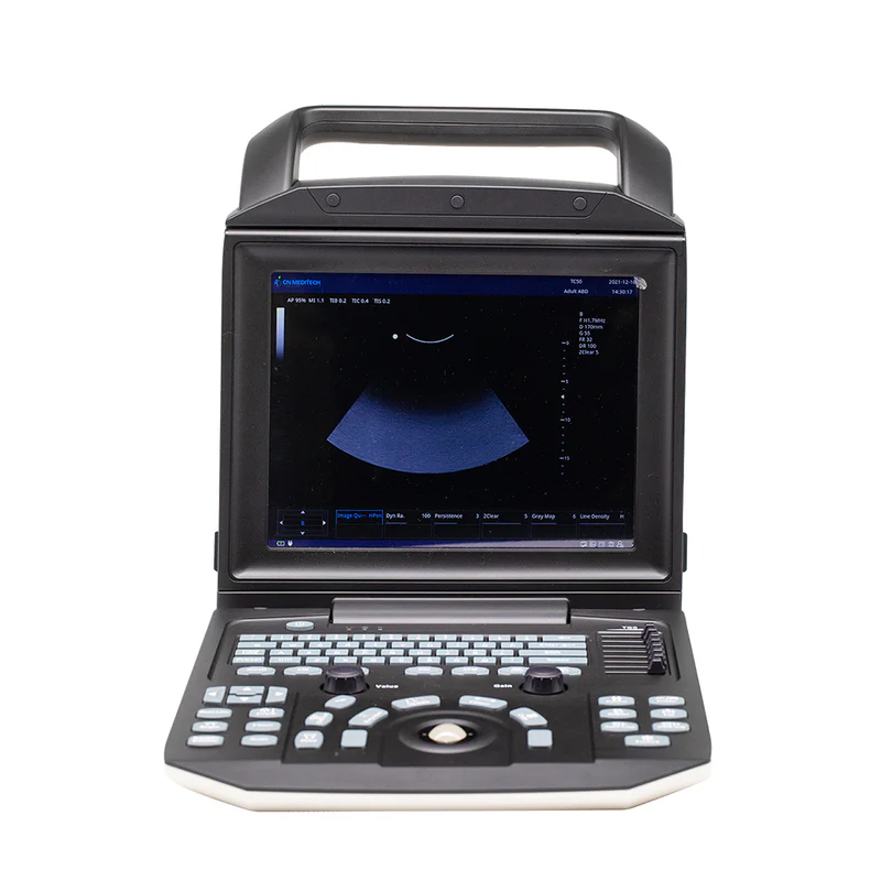 Color Doppler Ultrasound System Full Digital Portable Ultrasonic Diagnostic 